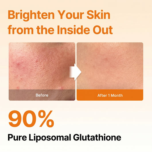 Novaro Liposomal Glutathione (30 Strips)